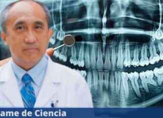 Tratamiento revolucionario para regenerar dientes será probado en humanos news-09082024-102332