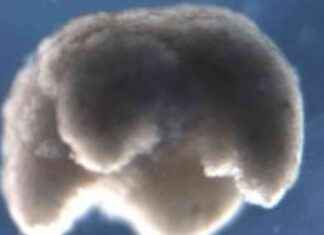 El tercer estado de la biología: La importancia de los organismos en estado de vida latente news-16092024-174659