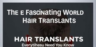 El Fascinante Mundo de los Trasplantes Capilares: Todo lo que Necesitas Saber The Fascinating World of Hair Transplants: Everything You Need to Know